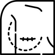 cicatrices-areoles